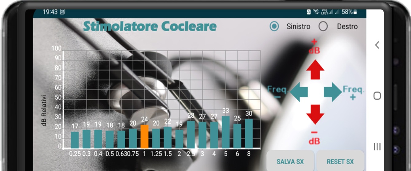 Metodo Re.Vo.Dis.System per l'applicazione audioprotesica
